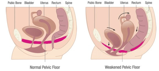 Diagram of a ladies pelvis mucles