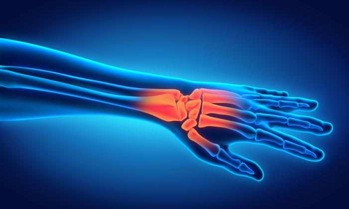 inflamed wrist xray